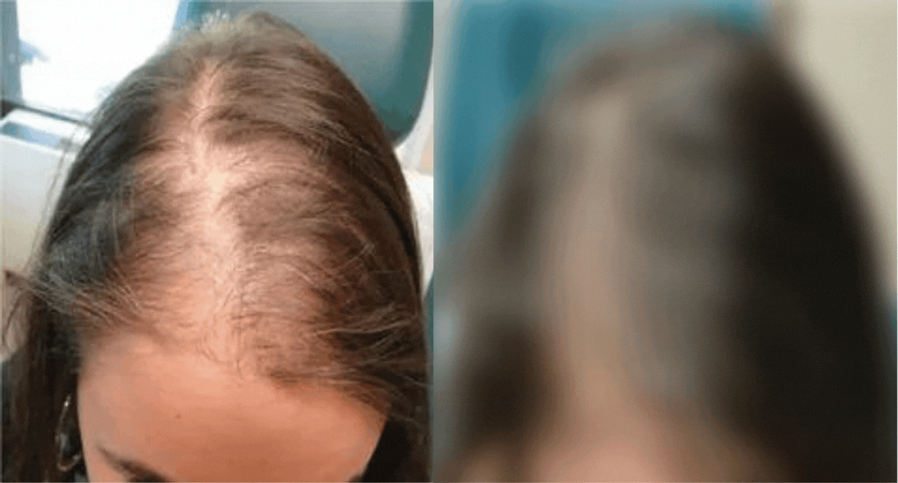 capelli commento