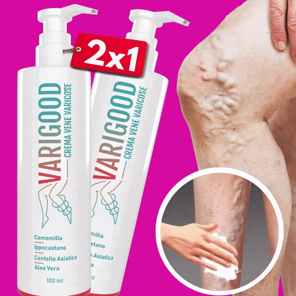 crema vene varicose